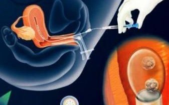 在赤峰学院附属医院做试管婴儿要多少钱？成功率怎么样？附试管怀孕机构名单一览