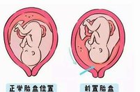 试管婴儿适合人群解读，这几种人生殖怀孕成功率高
